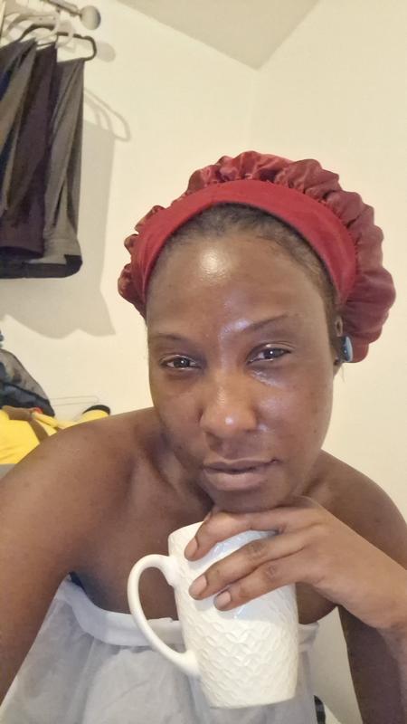 Customer photo for "Dark spot on my face fades away"