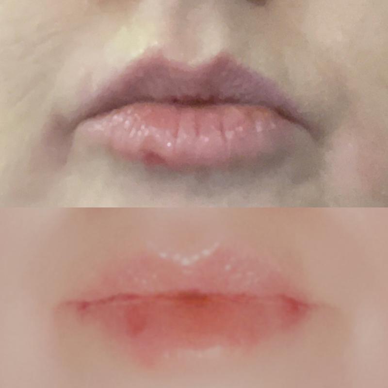 The cracks have healed and they are soft and plump. I can’t wait to see how they will look in a couple of weeks.