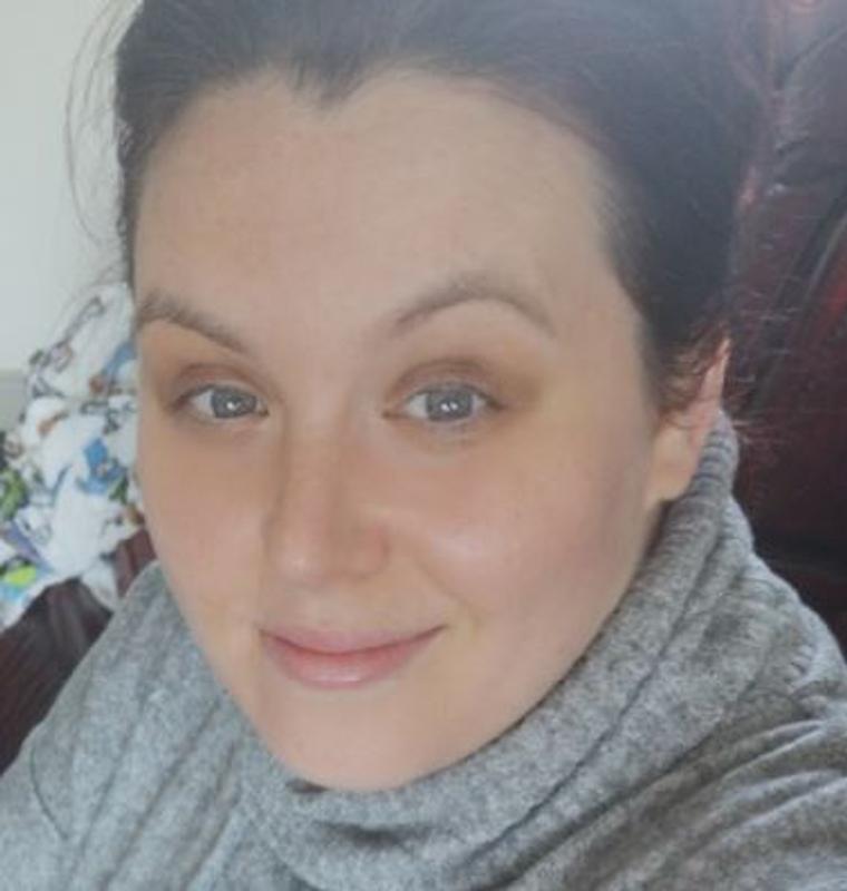 My skin has cleared up so much using this product. Highly recommend this!