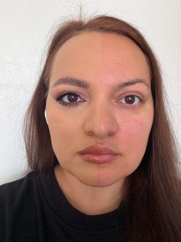 Customer photo for "The best coverage"