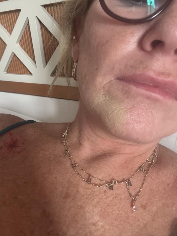 Too yellow ? Too sallow ?  Just wrong.