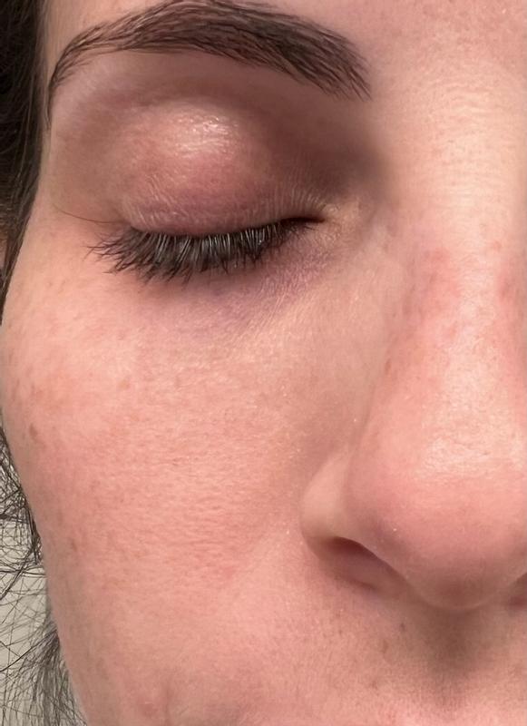 Review Thumbnail Image 0 179920338