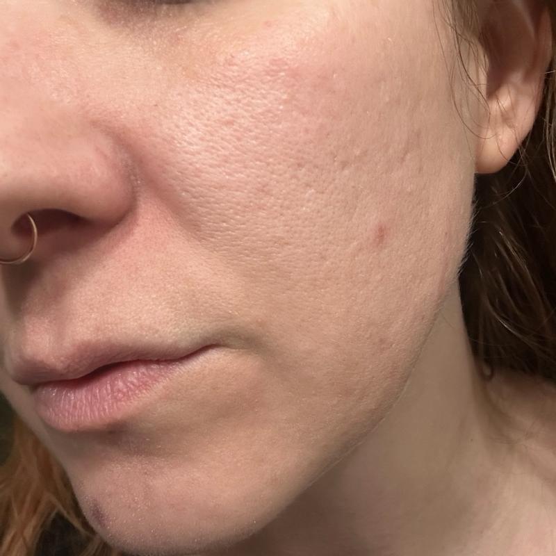 Customer carousel item 4.