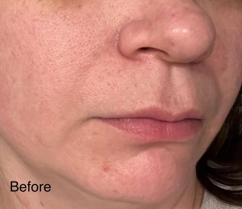 Review Thumbnail Image 0 180623015