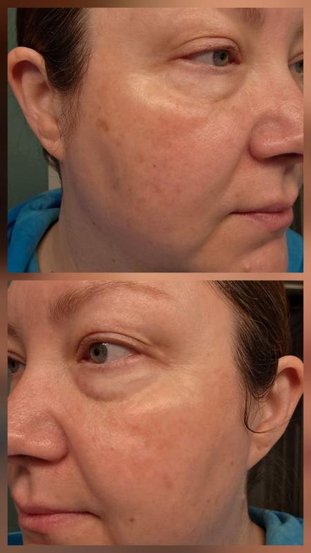 Review Thumbnail Image 0 180701480