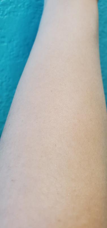 My arm looks smoother and healthier.