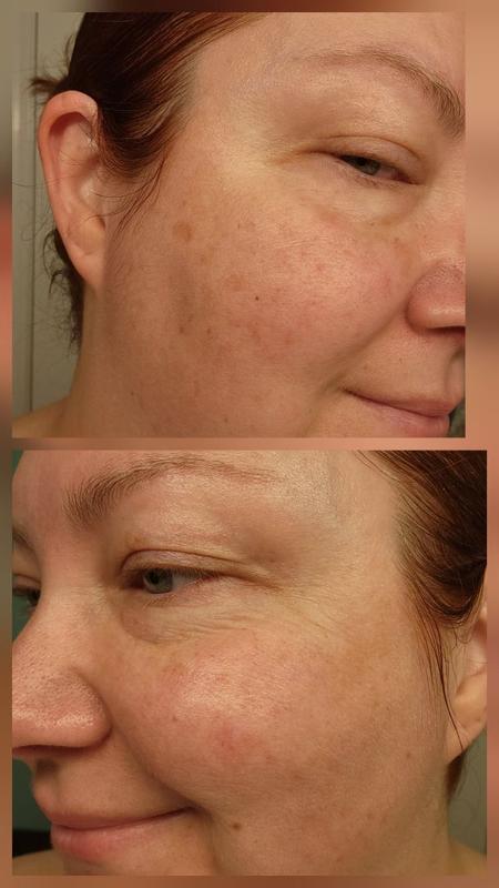 Review Thumbnail Image 3 180701480