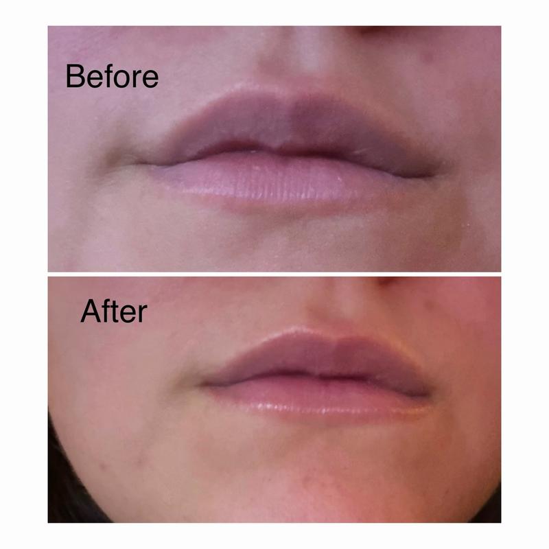 Review Thumbnail Image 0 181805424