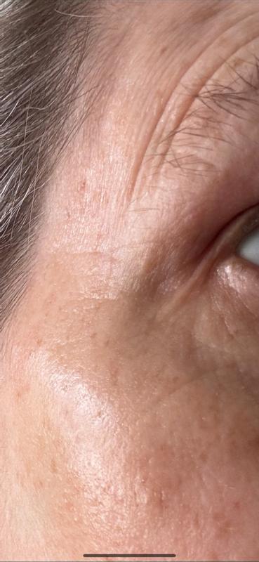 Review Thumbnail Image 1 180517309