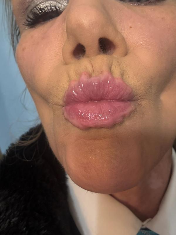 Review Thumbnail Image 0 180921300