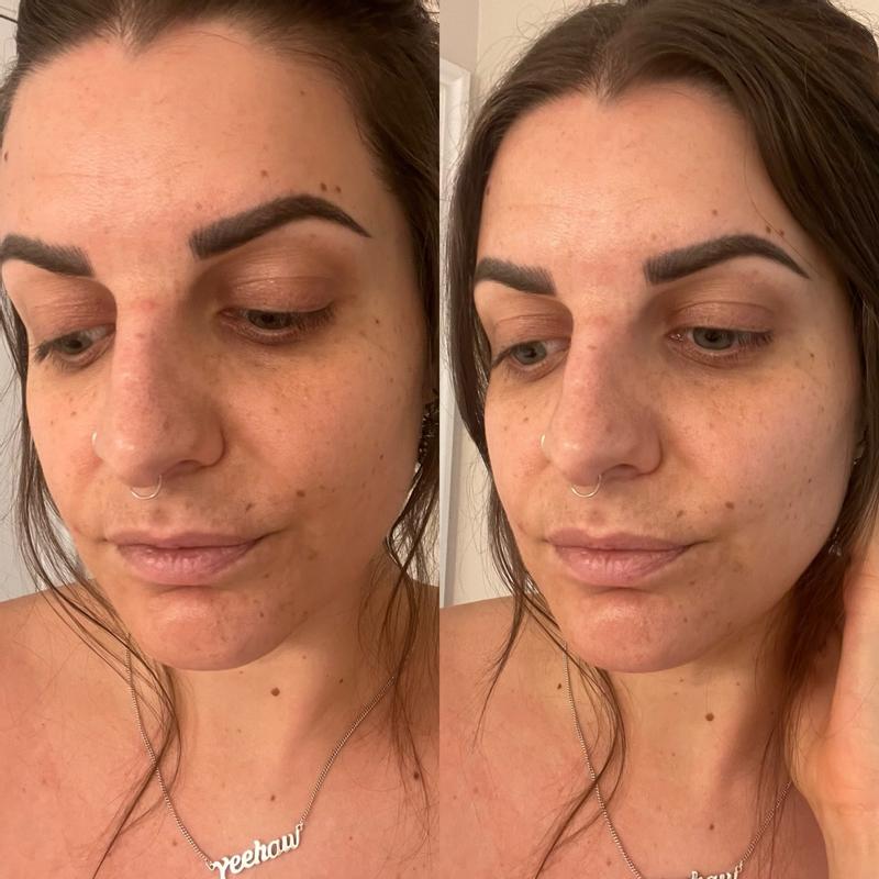 Customer carousel item 11.