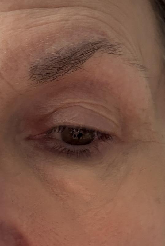 Customer photo for "Really minimizes lines"