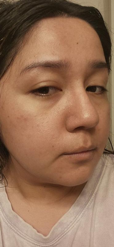 Review Thumbnail Image 0 179897458