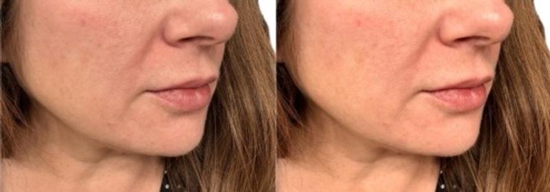 Review Thumbnail Image 1 180738619