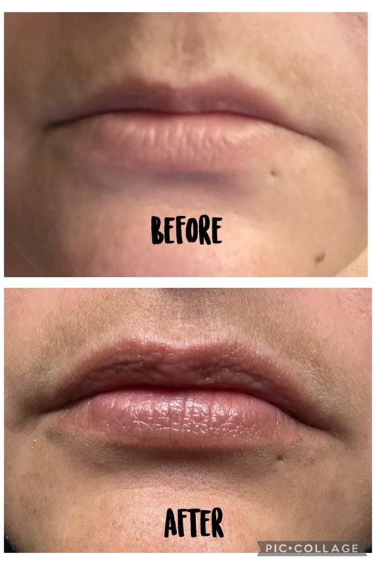 Review Thumbnail Image 0 180980241