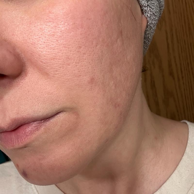 Customer carousel item 5.