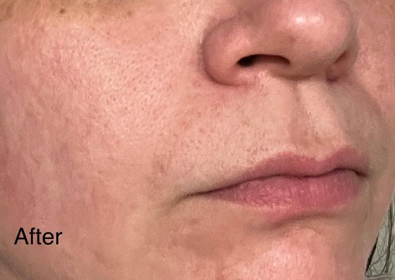 Review Thumbnail Image 1 180623015