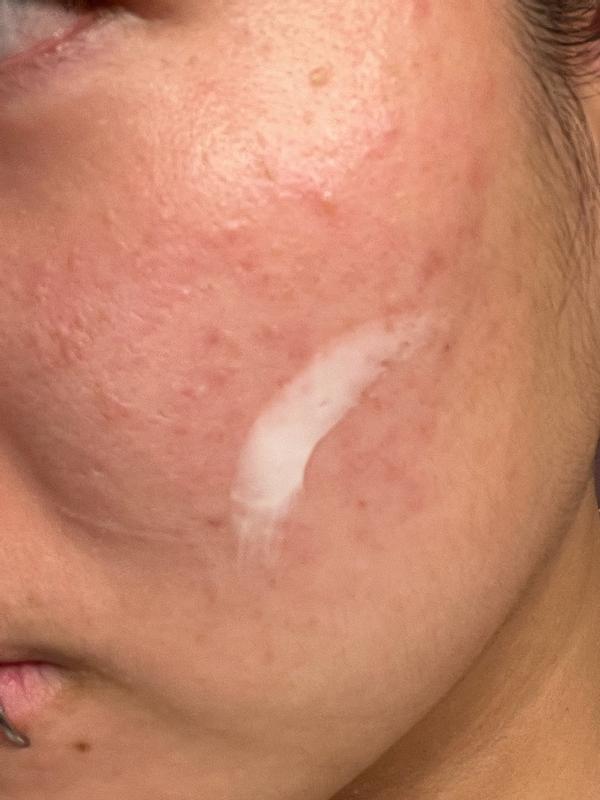 Review Thumbnail Image 0 179602079