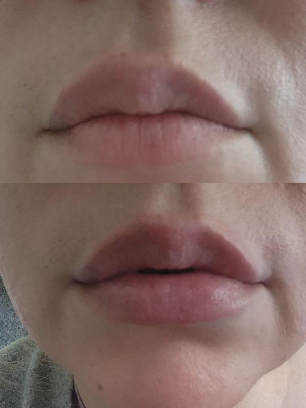 Review Thumbnail Image 0 180976431