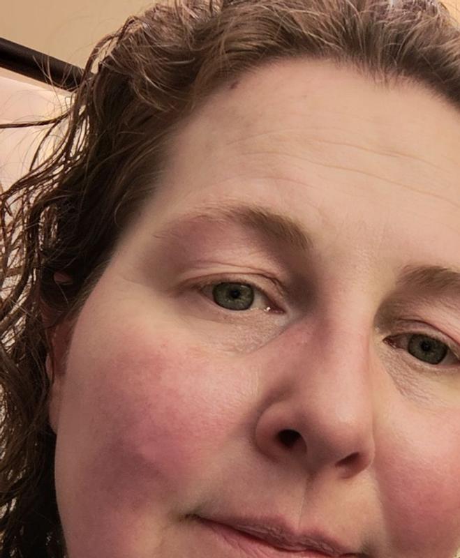 Review Thumbnail Image 1 180520601