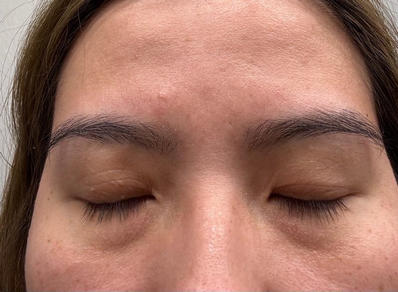 Customer photo for "great eye serum"