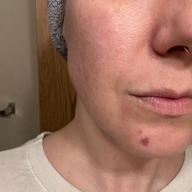 Customer carousel item 6.