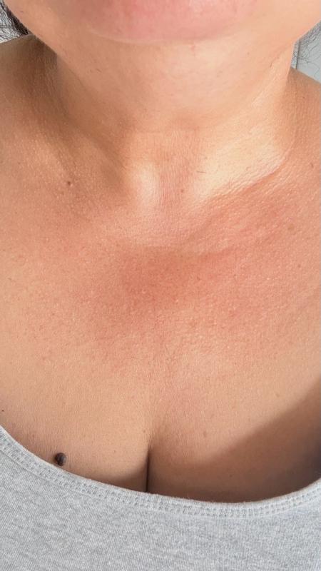 Customer photo for "Firmness elasticity  and aparience of neck wrinkles"