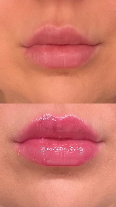 Customer carousel item 6.