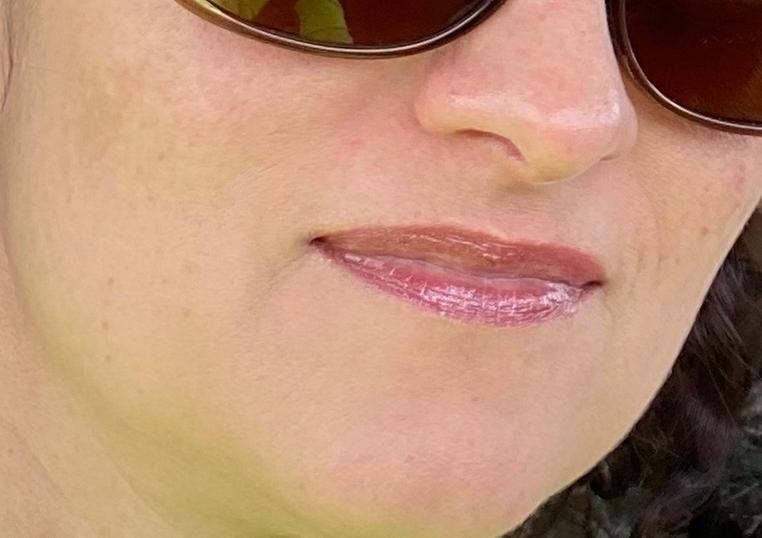 Diminishing dark spots and hydrated