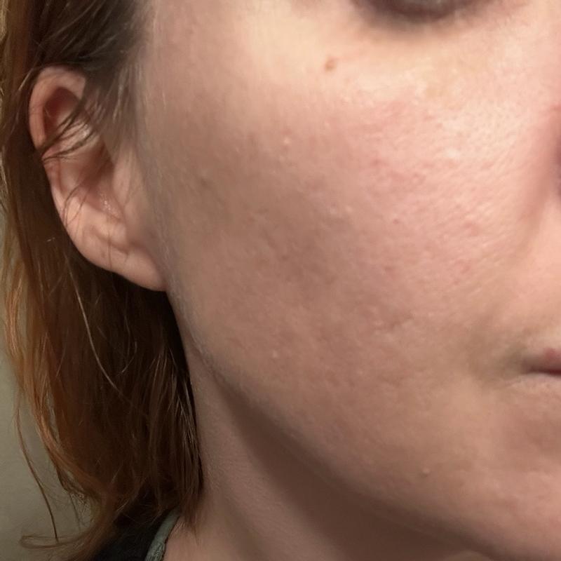 Customer carousel item 6.