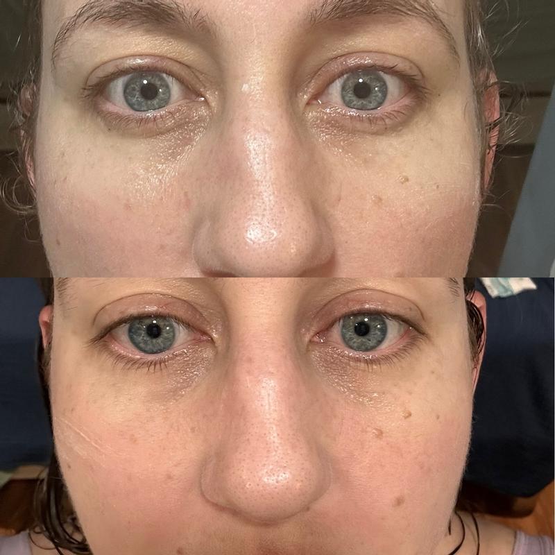 Review Thumbnail Image 0 180839046