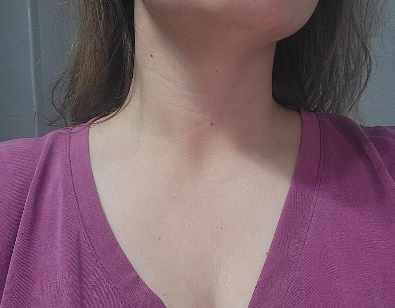 Customer photo for "Slightly noticeable results"