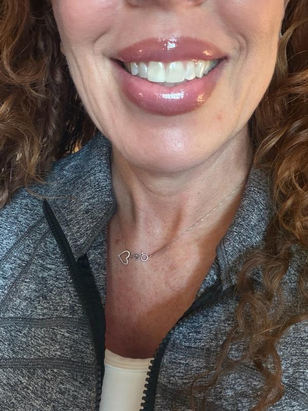 Review Thumbnail Image 0 180516011