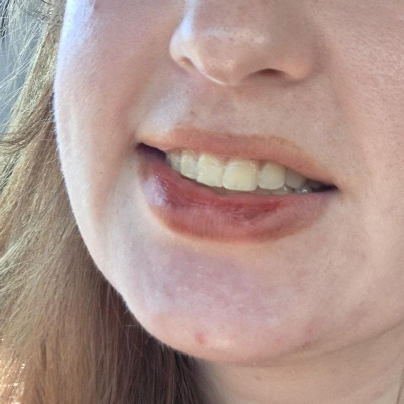 Customer photo for "Not a good lipstain!"
