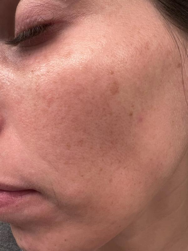 Review Thumbnail Image 2 179920338