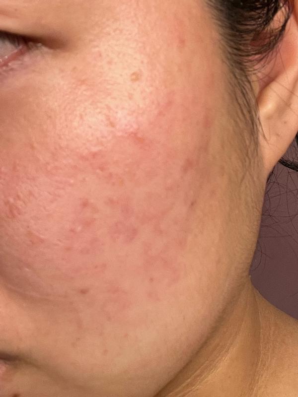 Review Thumbnail Image 1 179602079