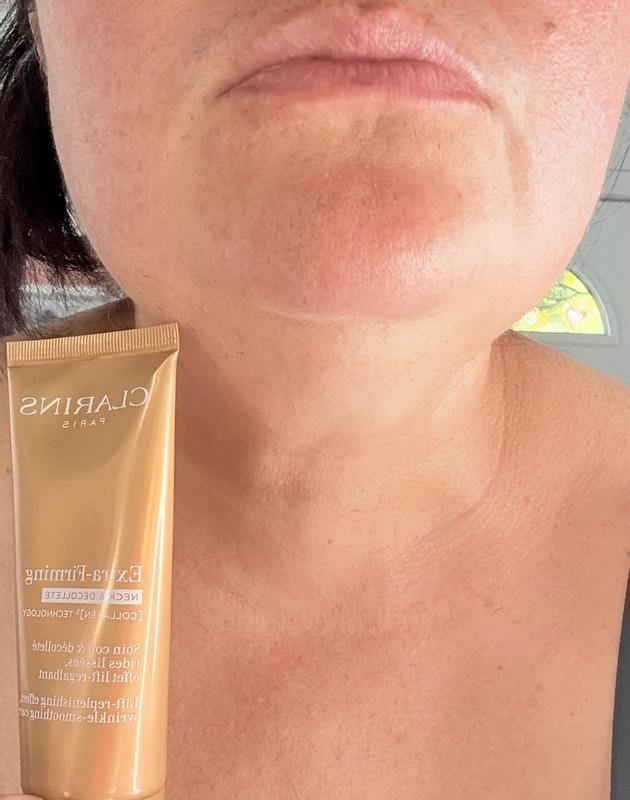 Customer photo for "Firmness elasticity  and aparience of neck wrinkles"