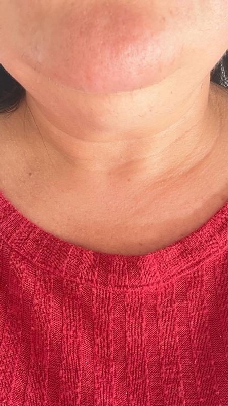 Customer photo for "Firmness elasticity  and aparience of neck wrinkles"