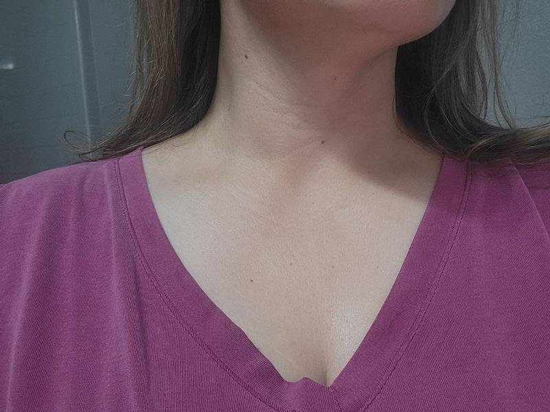 Customer photo for "Slightly noticeable results"