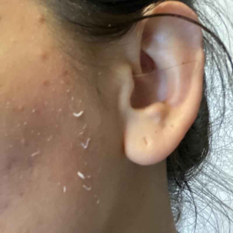 Customer photo for "Doesn’t absorb well"