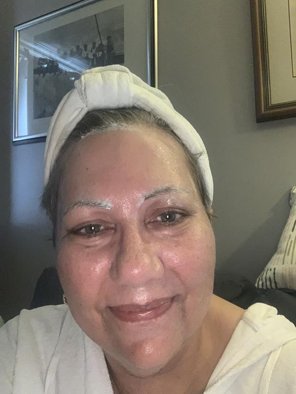 The before photo with the mask on