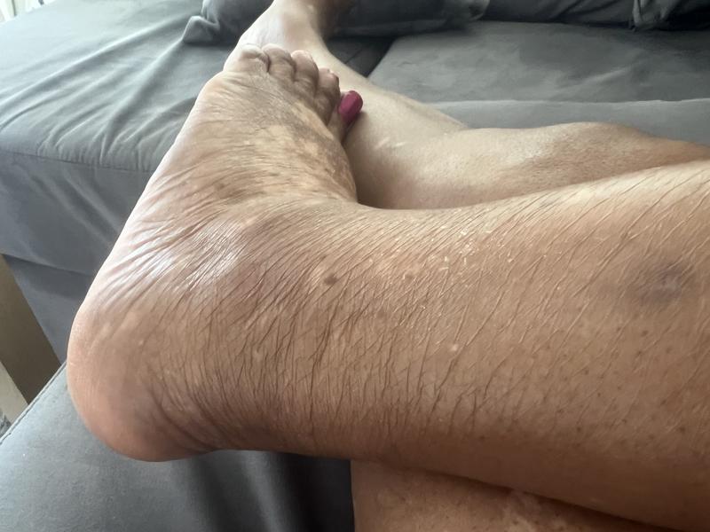 My skin , after using moisture rich for over a month