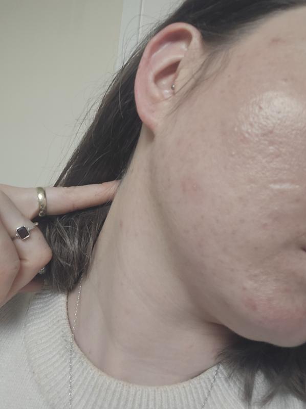 My skin after 1 hour