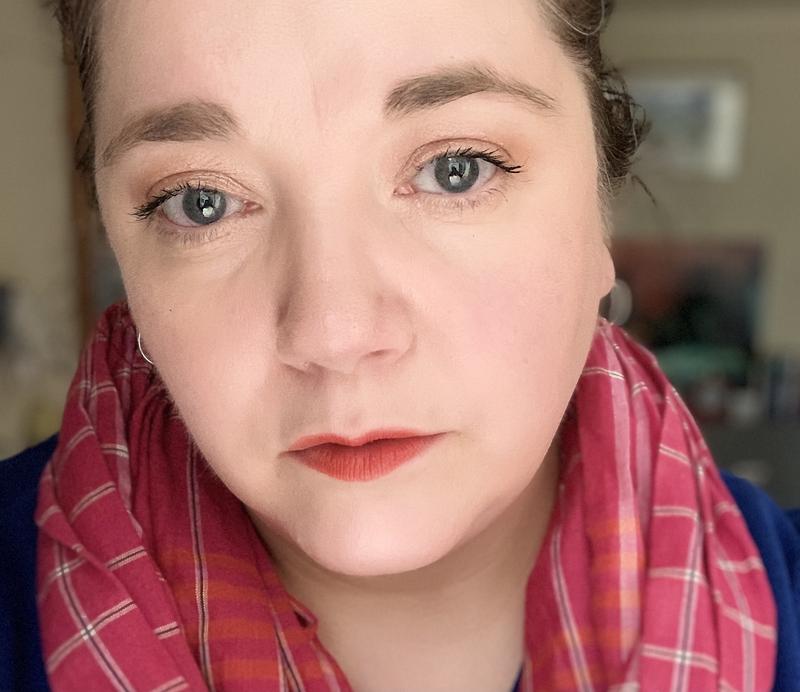 I have dark circles! This has really helped.