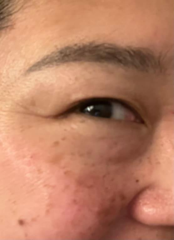 After