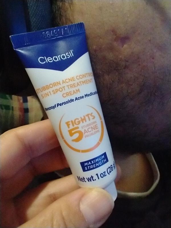 Clearasil deals acne cream