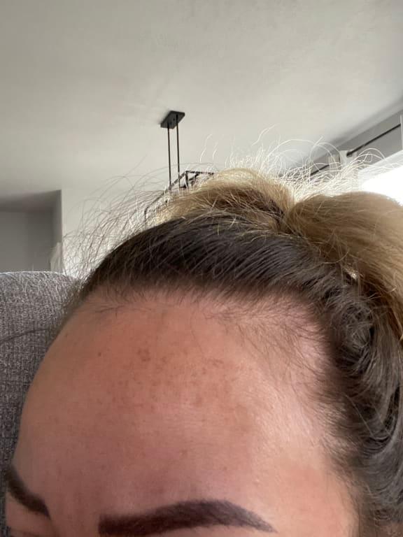 Its been months still no results i use it as with sunblock