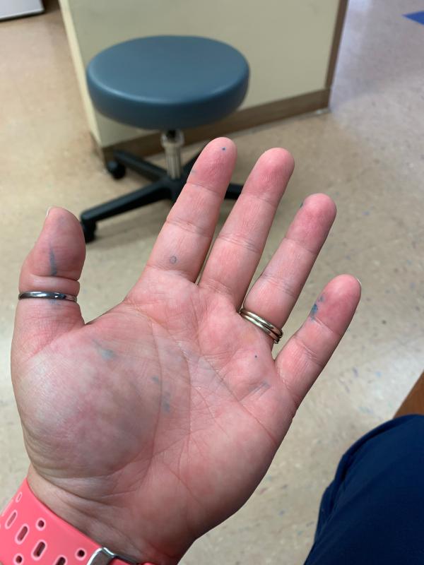 Take note pen leakage