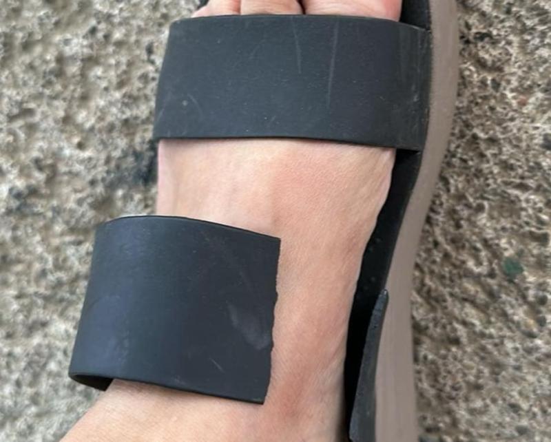 broken strap