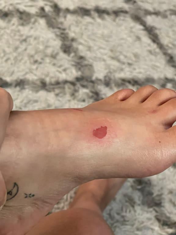 Photo submitted with review of product